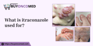 itraconazole Use