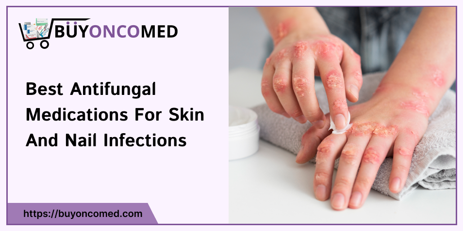 Skin and Nail Infections