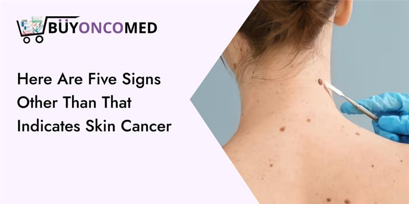skin cancer