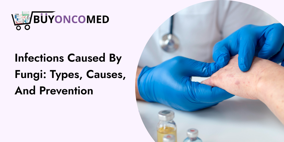 Fungal Infections